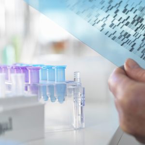 Researcher holding a DNA (deoxyribonucleic acid) gel during a genetic experiment in a laboratory