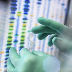 Scientist examining a sample in a lab with DNA sequencing gel in the background.